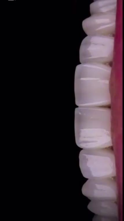 A Smile Makeover